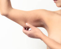 Picture of woman pinching her arm