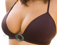 Picture of well-shaped breast implants